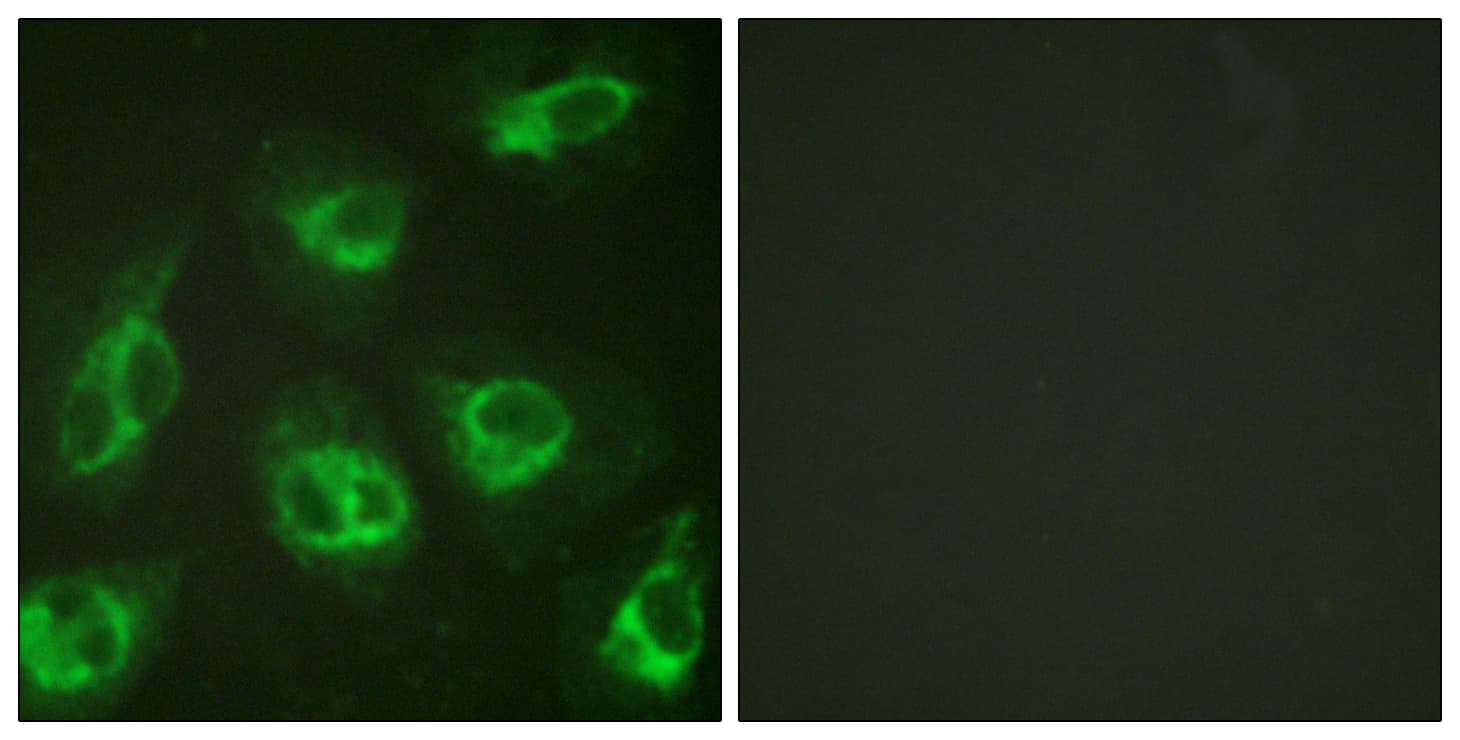 IHC-plus™ Polyclonal Rabbit anti-Human KCNIP3 / Dream / Calsenilin Antibody (aa29-78, IHC, IF, WB)