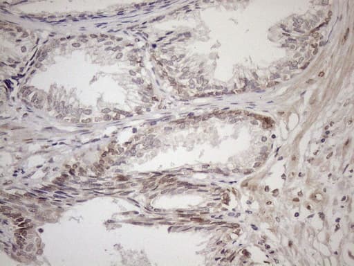 Monoclonal Mouse anti-Human AAAS / Adracalin Antibody (clone OTI5B10, aa322-546, IHC, WB)