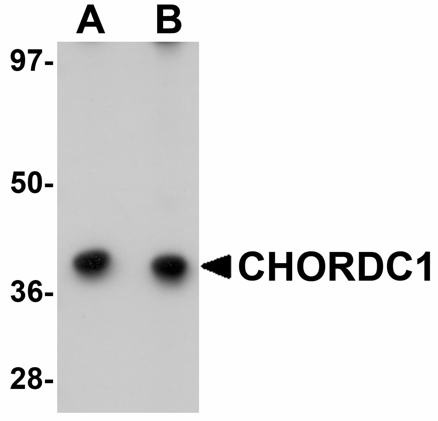 IHC-plus™ Polyclonal Rabbit anti-Human CHORDC1 / CHP1 Antibody (IHC, IF, WB)