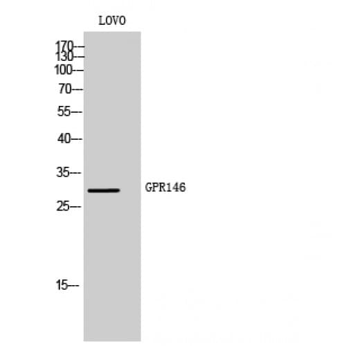 Polyclonal Rabbit anti-Human GPR146 Antibody (160-240 aa, Internal, IF, WB)