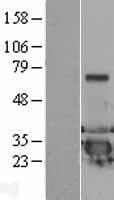 DCXR Protein (Over-Expression Lysate Myc-DDK (Flag))