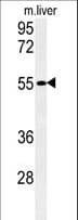 FAM151A Antibody (aa547-576)
