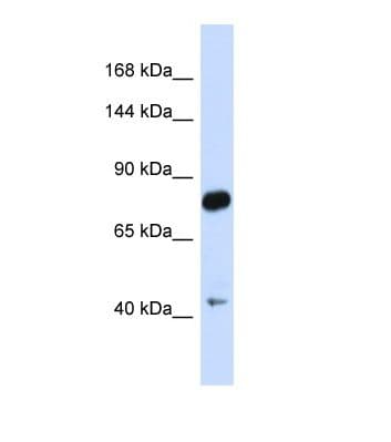 CDH23 / Cadherin 23 Antibody (aa109-158)