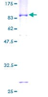 Human TROVE2 Protein (Recombinant GST)