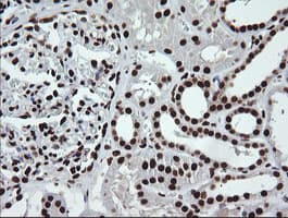 Monoclonal Mouse anti-Human SAE1 Antibody (clone 1G8, Carrier-free, IHC, IF, WB)