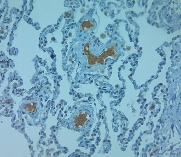 SLC11A2 / DMT1 Antibody