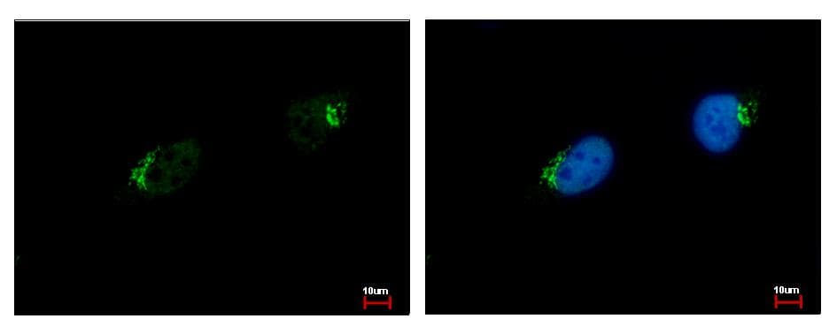 Polyclonal Rabbit anti-Human GALNT7 Antibody (aa24-515, IHC, WB)