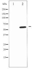 IL10RA Antibody
