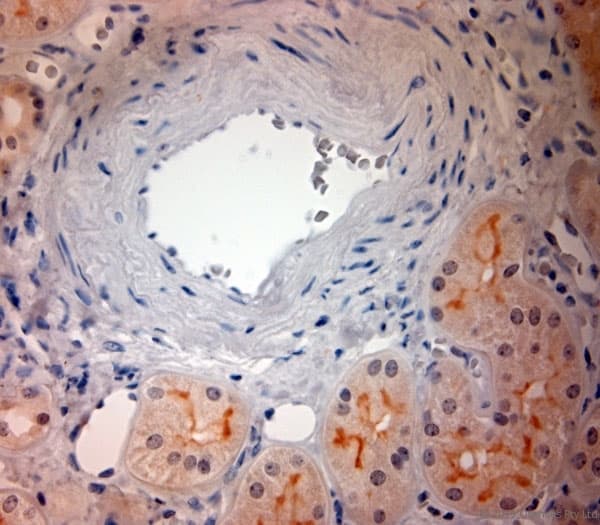 Polyclonal Rabbit anti-Human SLC17A3 Antibody (aa2-50, IHC)