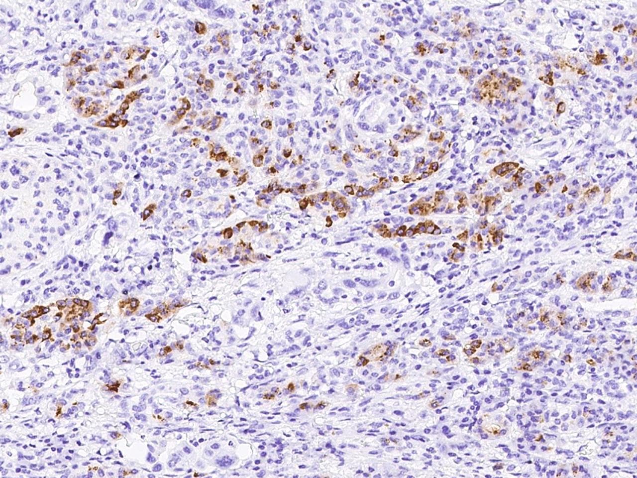 REG3A Antibody (Preservative Free)