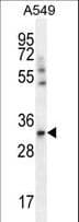 IHC-plus™ SLC25A6 / ANT3 Antibody (aa128-155)