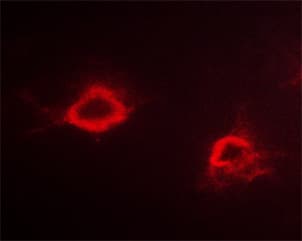 APP / Beta Amyloid Precursor Antibody (phospho-Thr743,pThr668)