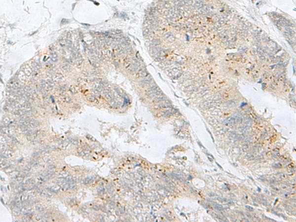 MLNR/GPR38/Motilin Receptor Antibody