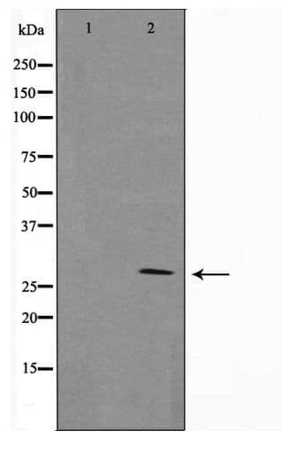 Polyclonal Rabbit anti-Human GZMB / Granzyme B Antibody (IHC, WB)