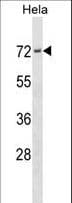 PRKCSH Antibody (aa6-35)