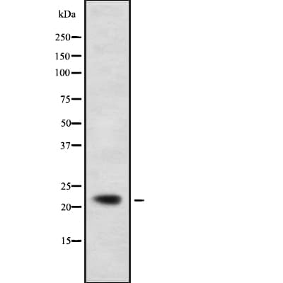 CMPK / CMPK1 Antibody