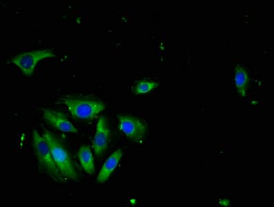 IHC-plus™ TNFSF10 / TRAIL Antibody (aa 39-281)