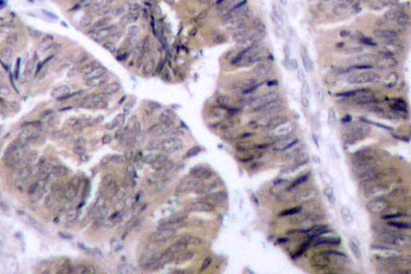 Polyclonal Rabbit anti-Human PRKAA1 / AMPK Alpha 1 Antibody (phospho-Ser486, IHC, WB)