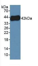 PF4V1 Antibody (aa1-104)