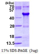 Human GPN1 / XAB1 Protein (Recombinant His)