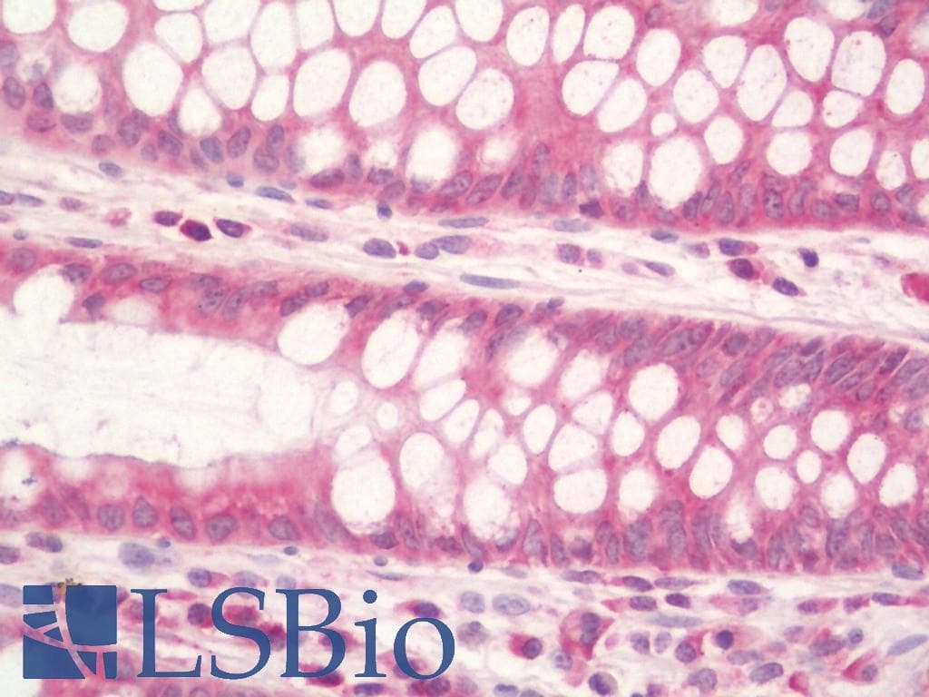 RPL3 / Ribosomal Protein L3 Antibody (HRP)