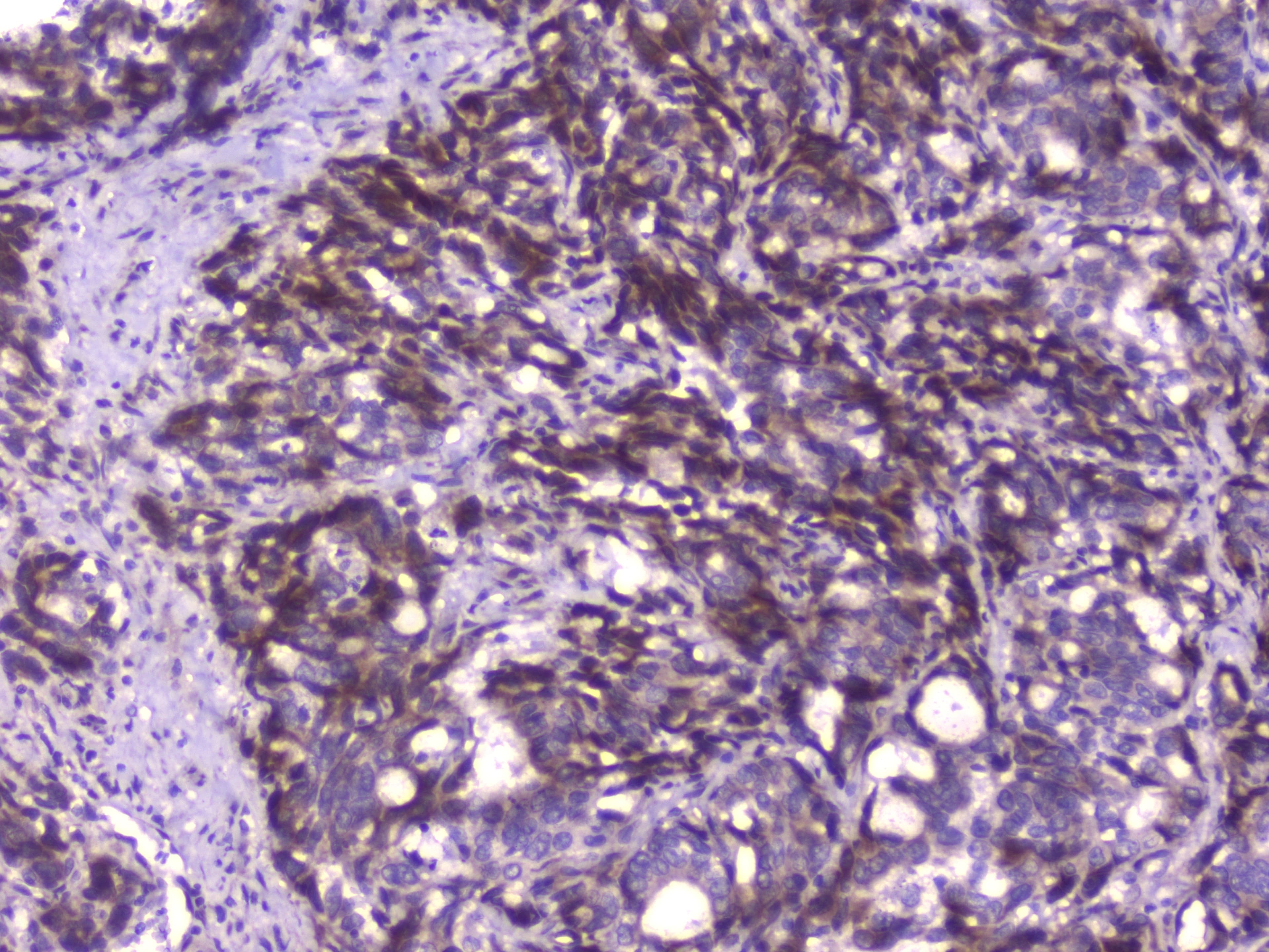 Polyclonal Rabbit anti-Human Capicua / CIC Antibody (IHC)