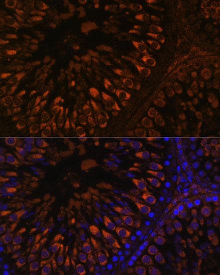 Polyclonal Rabbit anti-Human FER1L5 Antibody (IF)