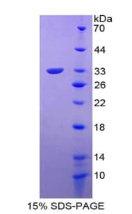 Human TBX4 Protein (Recombinant)