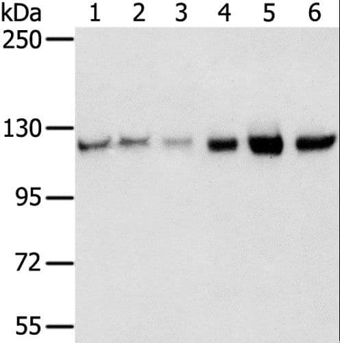 Polyclonal Rabbit anti-Human RBM5 / G15 Antibody (IHC, WB)