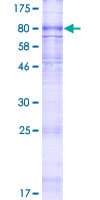 Human ABCC11 / MRP8 Protein (Recombinant GST)