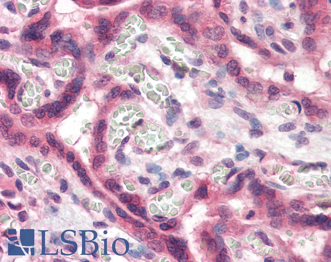 IHC-plus™ Polyclonal Rabbit anti-Human TFF2 / SP Antibody (Internal)
