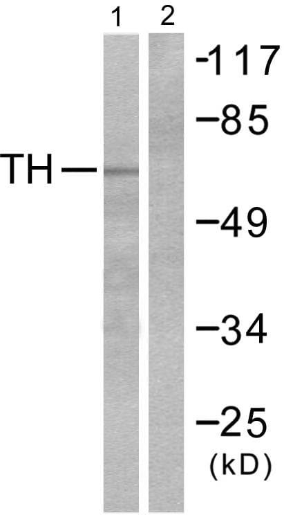 TH / Tyrosine Hydroxylase Antibody (p31)