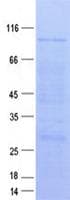 Human PI16 Protein (Recombinant GST, N-terminus + His, C-terminus)