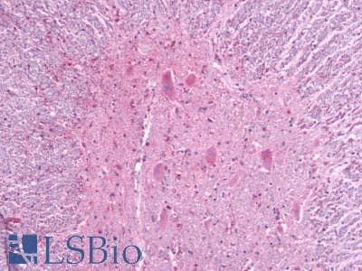 PathPlus™ MRGPRF Antibody (N-Terminus)