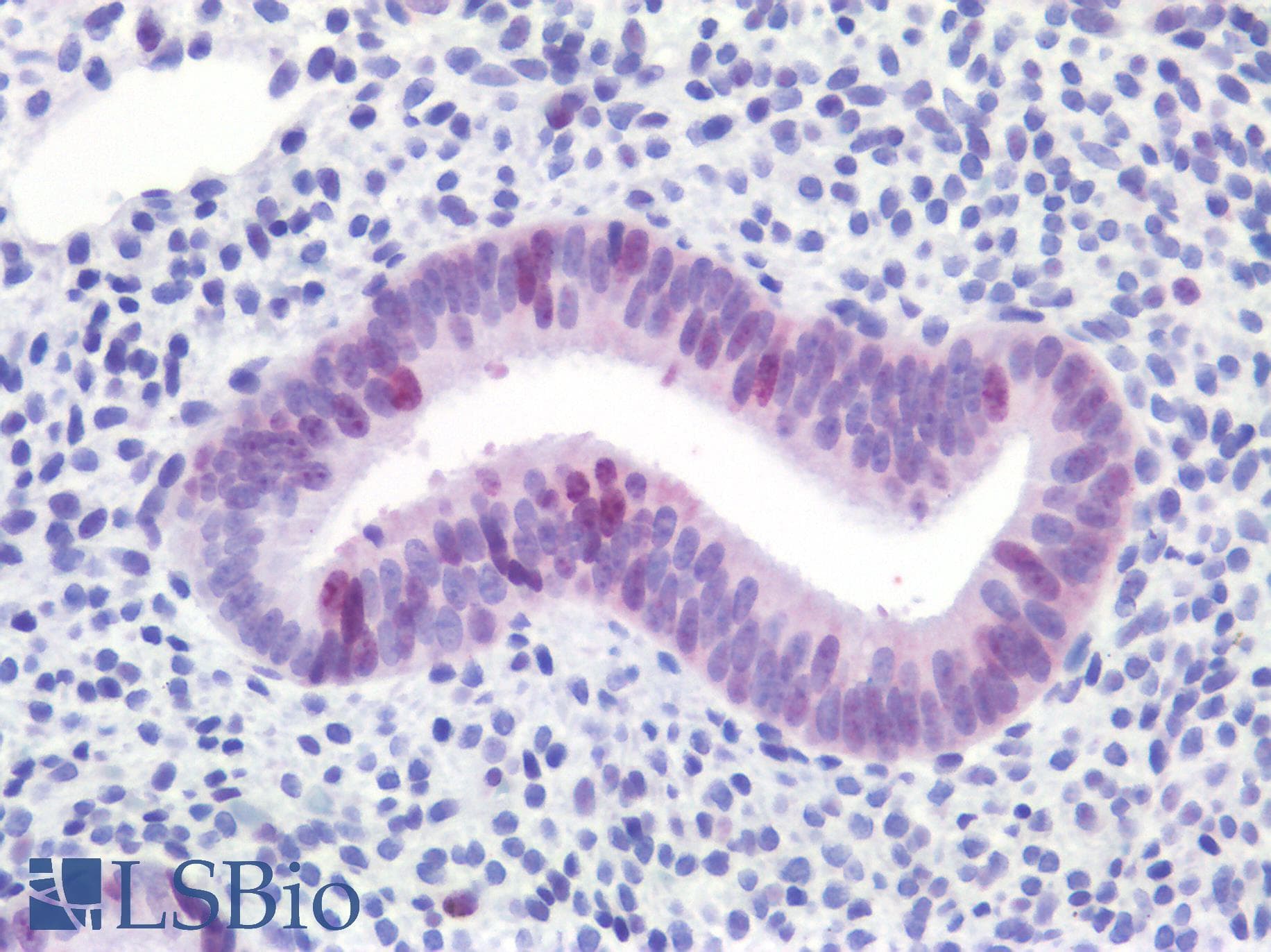 IHC-plus™ Polyclonal Rabbit anti-Human MKI67 / Ki67 Antibody (IHC)