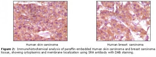 SRA1 / SRA Antibody (clone 1D4H8)