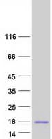 Human SPACA3 Protein (Recombinant Myc-DDK (Flag))