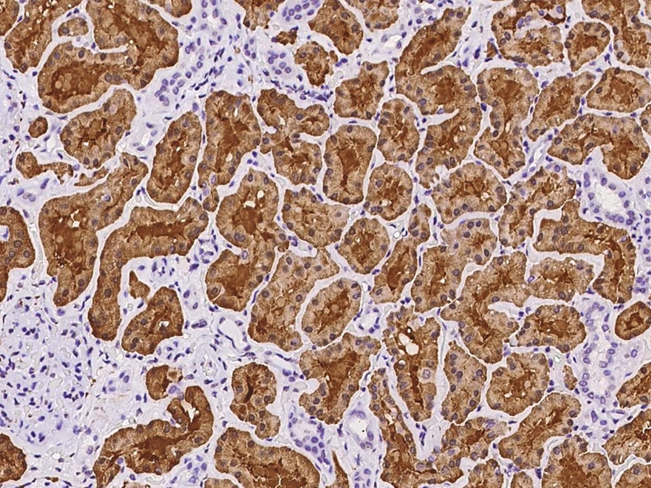 ALDOB Antibody