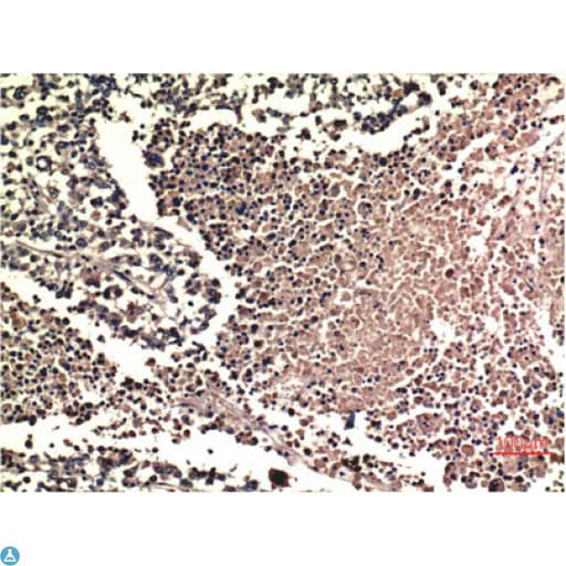 ERK1 + ERK2 Antibody