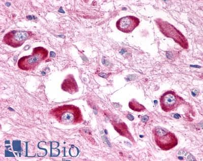 PathPlus™ Polyclonal Rabbit anti-Human GPR146 Antibody (C-Terminus, IHC)