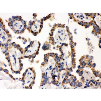 WAS / WASP Antibody (aa129-156)