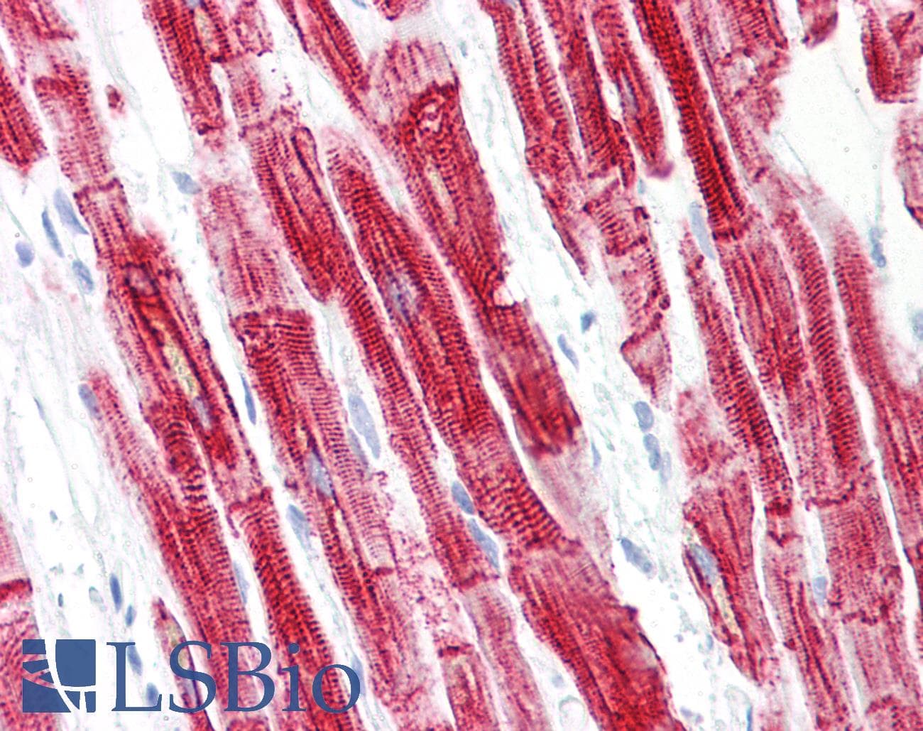 PathPlus™ DES / Desmin Antibody (clone D9)