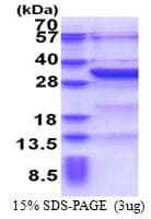 Human KCTD4 Protein (Recombinant His)