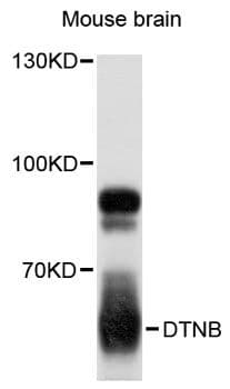 DTNB / Dystrobrevin Beta Antibody