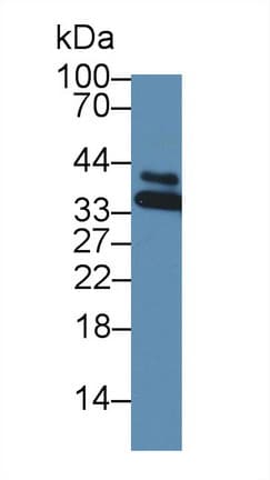 HNRPA1 / HnRNP A1 Antibody (aa2-320)