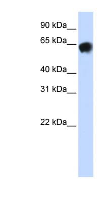 Polyclonal Rabbit anti-Human ALB / Serum Albumin Antibody (aa540-589, IHC, WB)