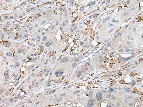 CD14 Antibody