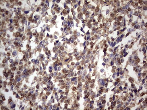 Monoclonal Mouse anti-Human GLI / GLI1 Antibody (clone OTI2E1, aa755-1106, IHC, WB)