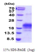Human ALK-6 / BMPR1B Protein (Recombinant His)