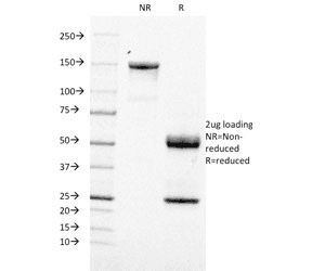 CR2 / CD21 Antibody (clone CR2/1953)